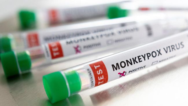 Ilustrasi sampel virus Monkeypox - Reuters