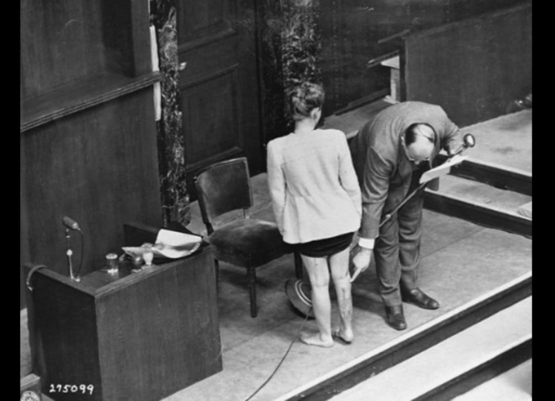 Jadwiga Dzido, salah satu penyintas eksperimen kejam Nazi, menghadiri Pengadilan Dokter 1946 dan menunjukkan luka pada kakinya. (Sumber: Holocaust Encyclopedia)