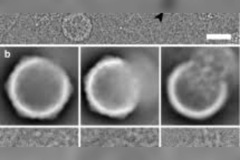Tampilan porcine cytomegalovirus melalui mikroskop elektron. (Sumber: SpringerLink)