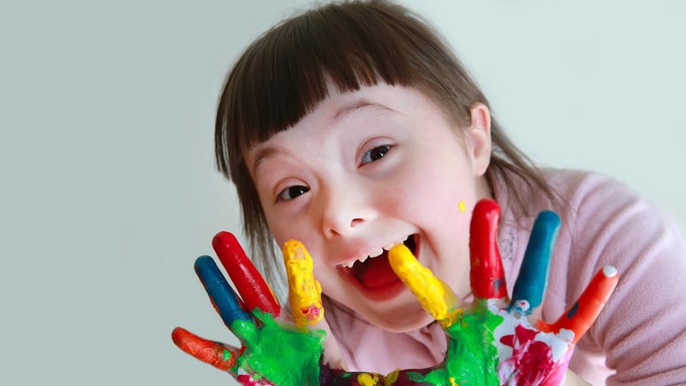 21 Maret: Mengenal Lebih Dekat Hari Down Syndrome Sedunia