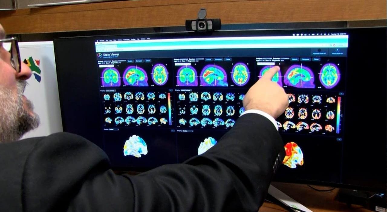 AI Pemeta Dimensia